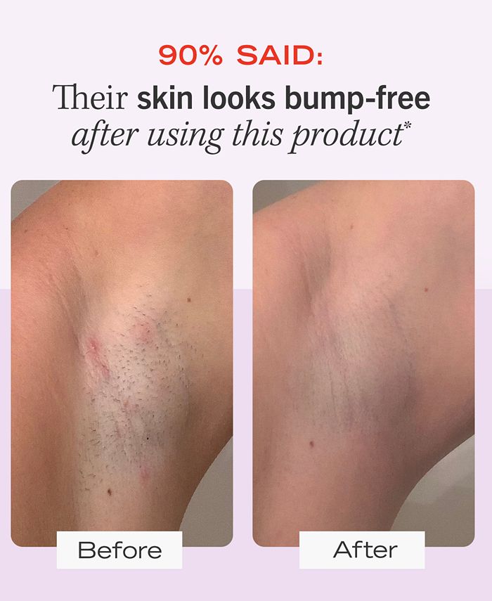 First Aid Beauty Ingrown Hair Pads With BHA & AHA, 60 pads Macy's