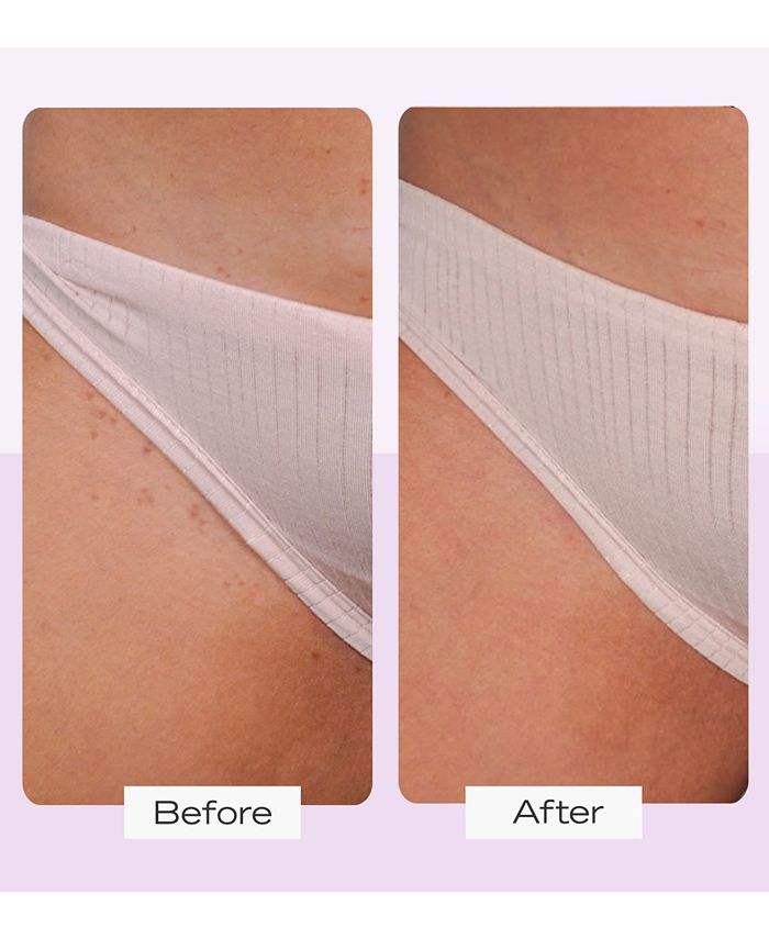 First Aid Beauty Ingrown Hair Pads With BHA & AHA, 28 Pads Macy's