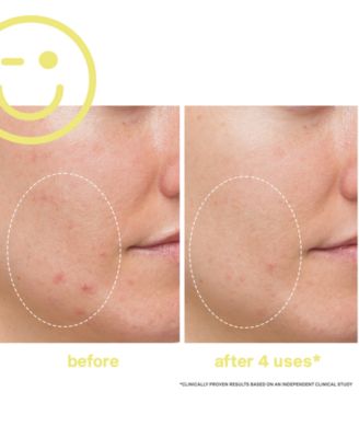 Mega-C 30% Vitamin C Brightening Facial, 2 oz.