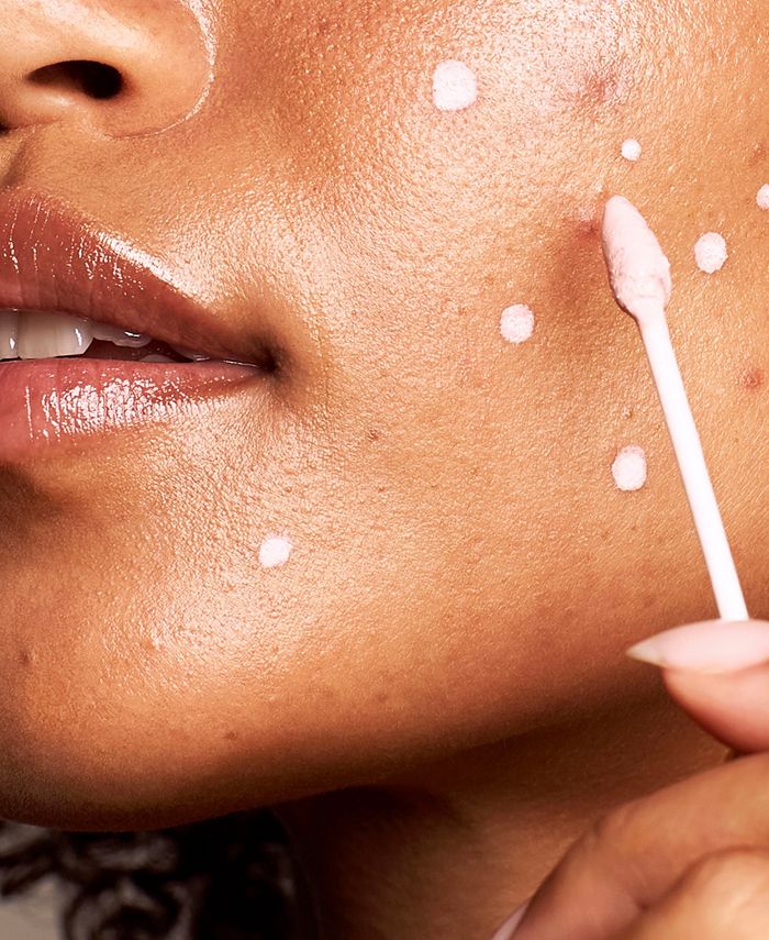 KATE SOMERVILLE EradiKate Acne Treatment, 1 oz. Macy's