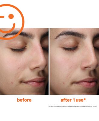 ExfoliKate Cleanser Daily Foaming Wash, 1.7 oz.