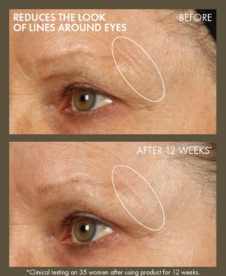 Plantscription Active Wrinkle Correction Serum, 1 oz.