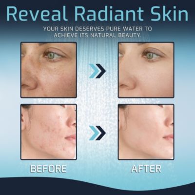 Water Softening Chrome Shower Filter with 2 Cartridges, 15-Stage Filtration for Skin and Hair Care