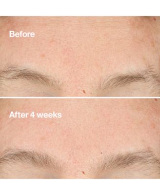 Clarifying Do-Over Peel, 1oz