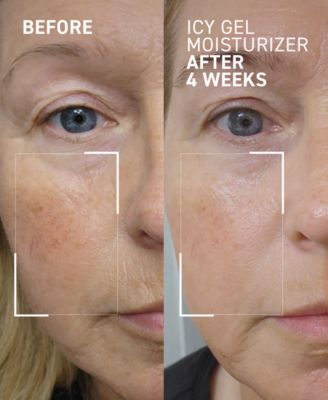 Icy Gel Moisturizer, 1.7 oz.