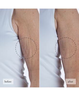 Ultimate Miracle Worker Resurfacing Body Serum, 6.5 oz.