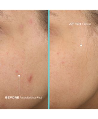 Facial Radiance Pads with Glycolic + Lactic Acids – Exfoliating Pads with AHA, 60 pads