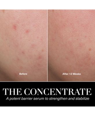 The Concentrate, 0.5 oz.