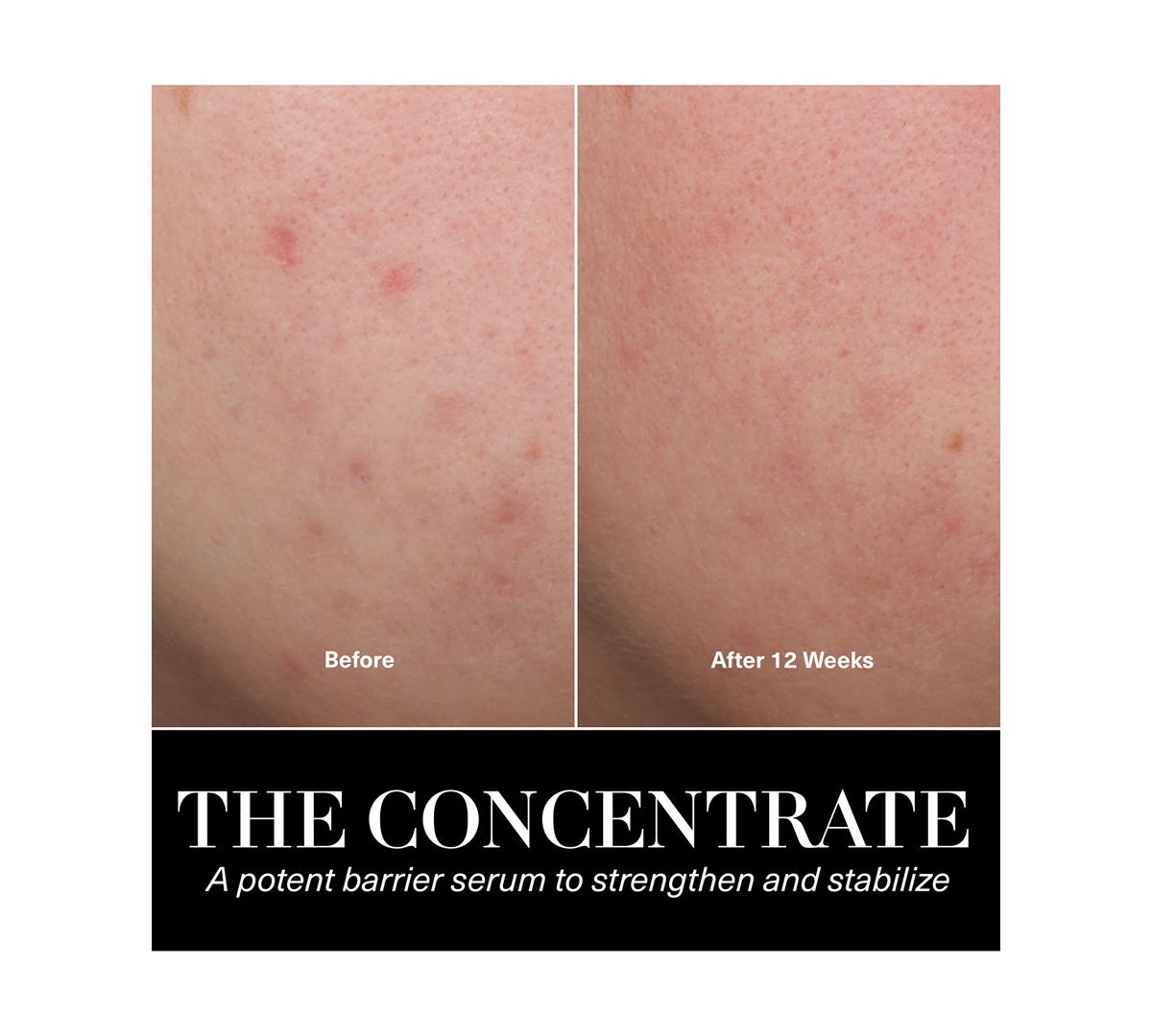 La Mer The Concentrate, oz