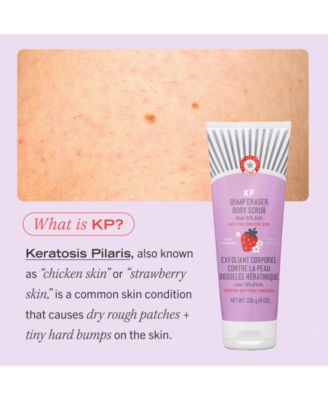 KP Bump Eraser Body Scrub With 10% AHA - Fresh Strawberry, 8 oz.