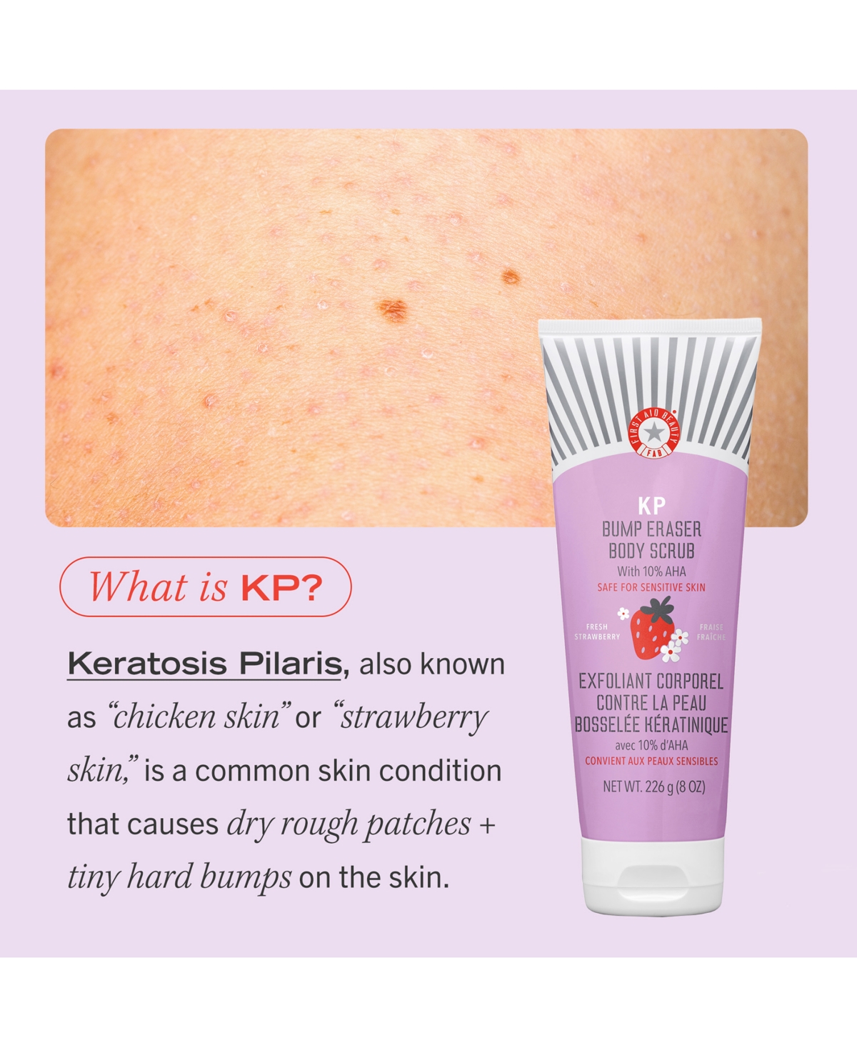 First Aid Beauty Kp Bump Eraser Body Scrub With 10% Aha In No Color