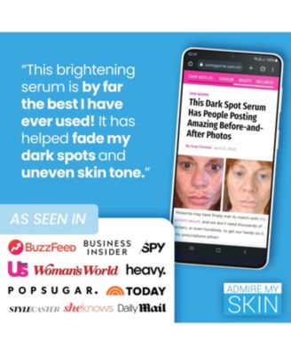 Dark Spot Corrector Remover for Face Ultra Potent Brightening Serum