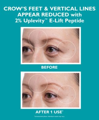 Peptide Skinjection Expression Line Hydra-Gel Patches, 60 patches