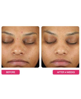 Universal Triple Action Daily Peel Pads, 10-Pk.