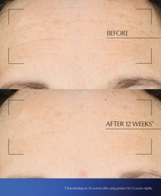 Advanced Night Repair Moisturizing Overnight Treatment with Hyaluronic Acid, 2.2 oz.