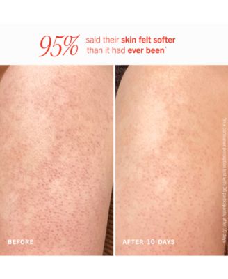 KP Bump Eraser Body Scrub With 10% AHA - Peach, 2 oz.