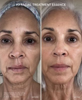 PITERA™ 6-Pc. Anti-Aging Set