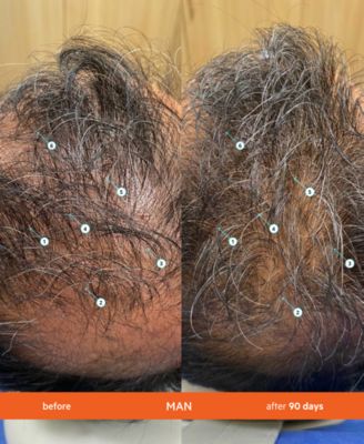 2-Pc. Revita High-Performance Hair Density Shampoo & Conditioner Set