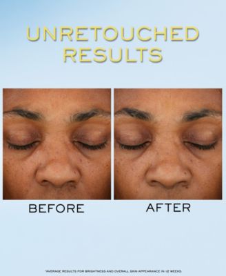 UV Expert Supra Screen Invisible Sunscreen Serum SPF 50