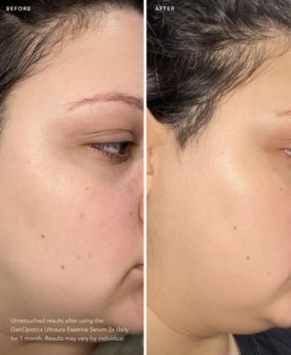 GenOptics Ultraura Essence Serum, 1.6 oz.