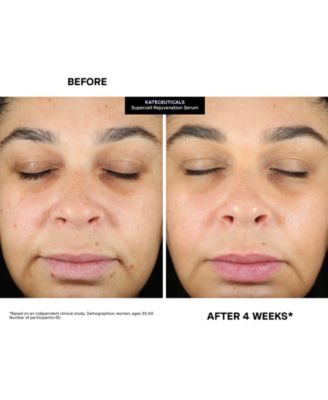 KateCeuticals SuperCell Rejuvenation Serum, 1 oz.