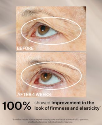 Peptight 360 Tightening Eye Serum, 1 oz