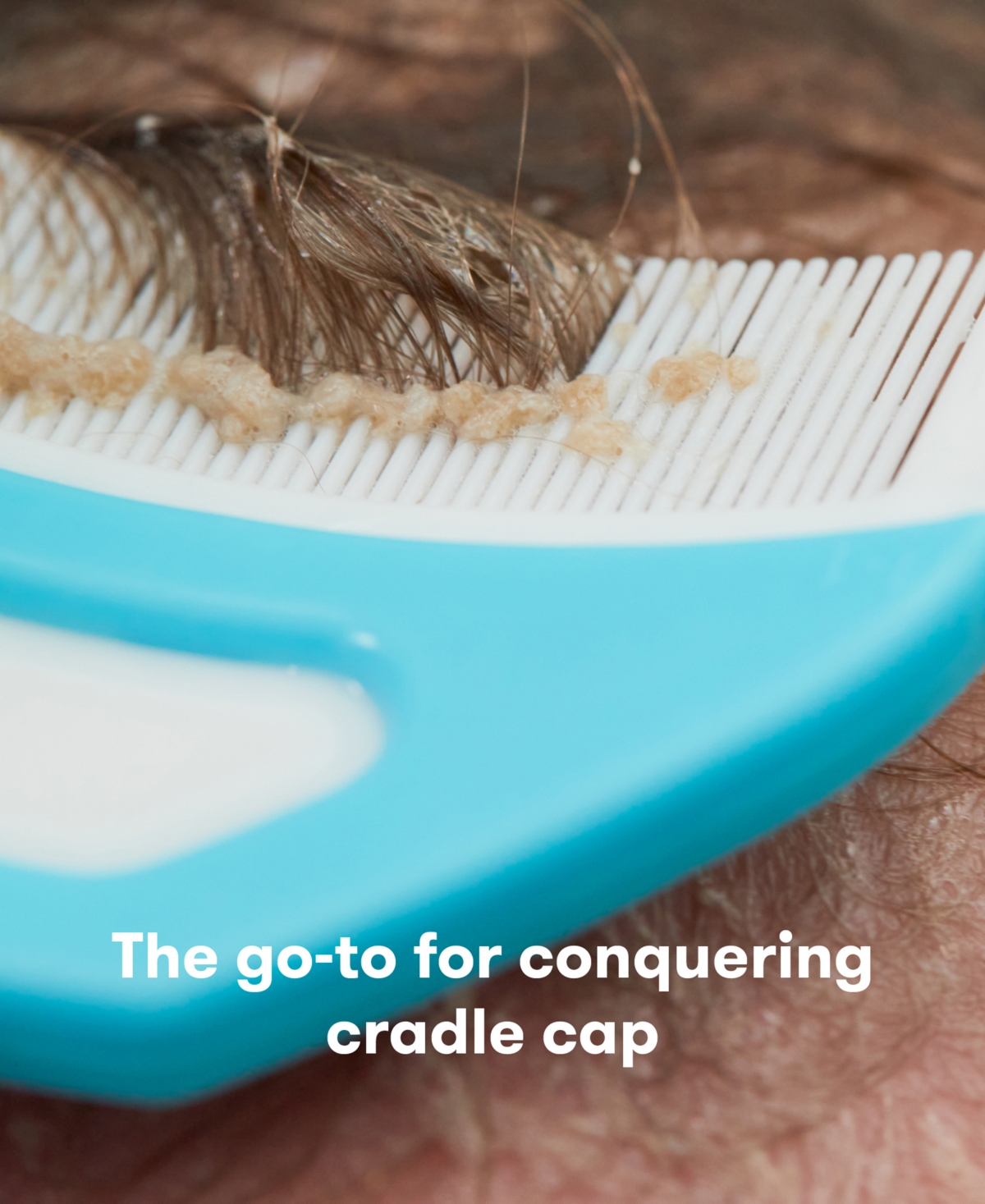 Frida Derma The Flakefixer The 3-step Cradle Cap System By Baby In White
