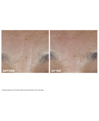 3-Pc. Total Eye Lift Set