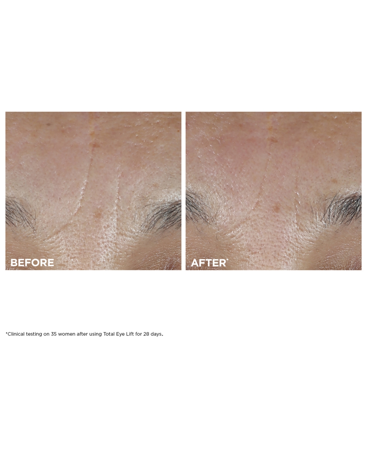 Clarins 3-pc. Total Eye Lift Set In Red