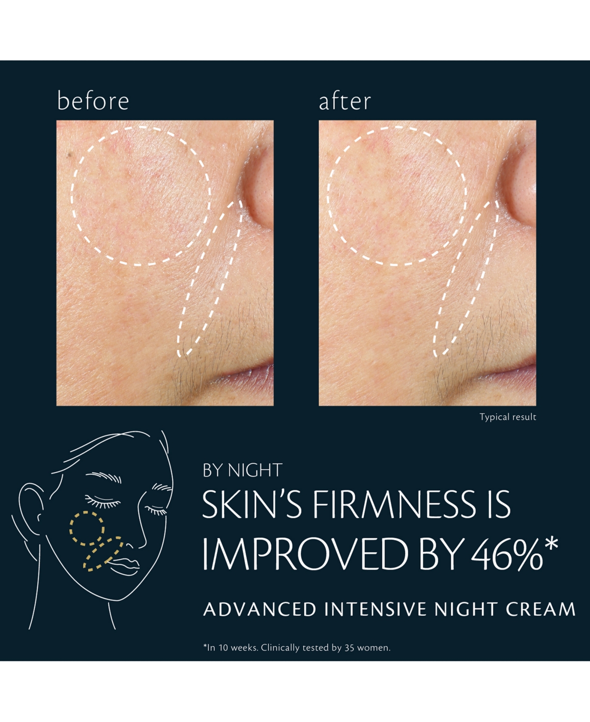 Clé De Peau Beauté Advanced Intensive Night Cream Refill, 1.7 Oz. In Transparent