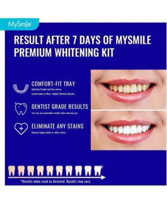 Prefilled Teeth Whitening Trays Kit, 12% Hydrogen Peroxide, Non-Liquid Gel Technology Tooth Whitening Trays, Whiten Teeth Faster, 7X Whitening Treatments Helps Remove Years of Stains
