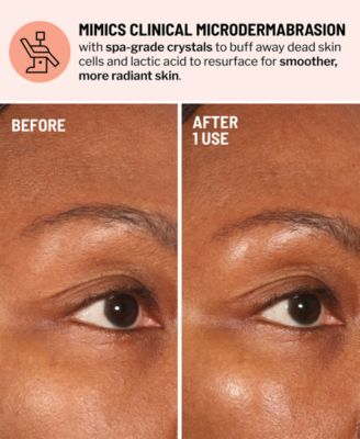 Advanced Microdermabrasion Face Exfoliator