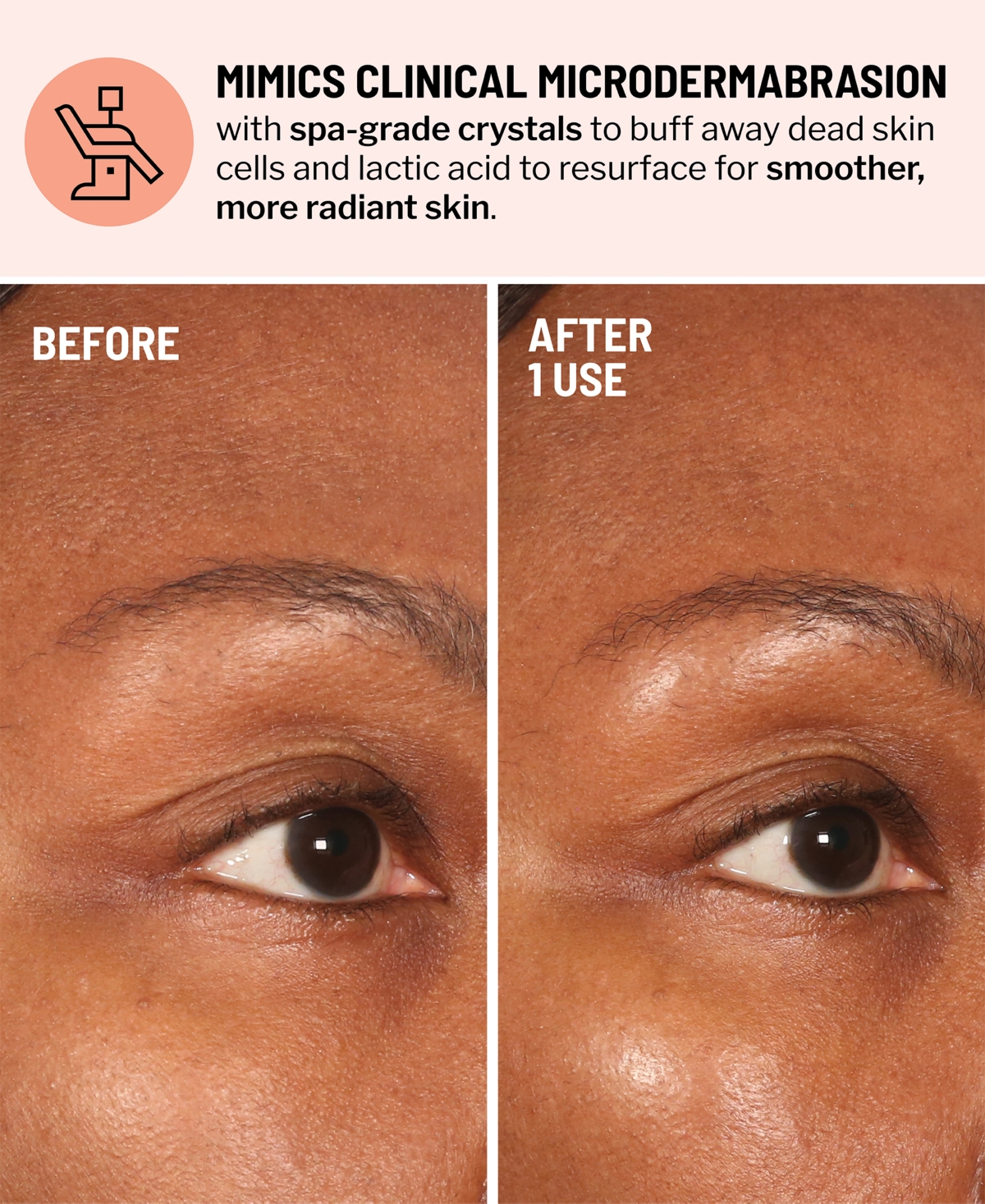 Dr. Brandt Advanced Microdermabrasion Face Exfoliator In Transparent