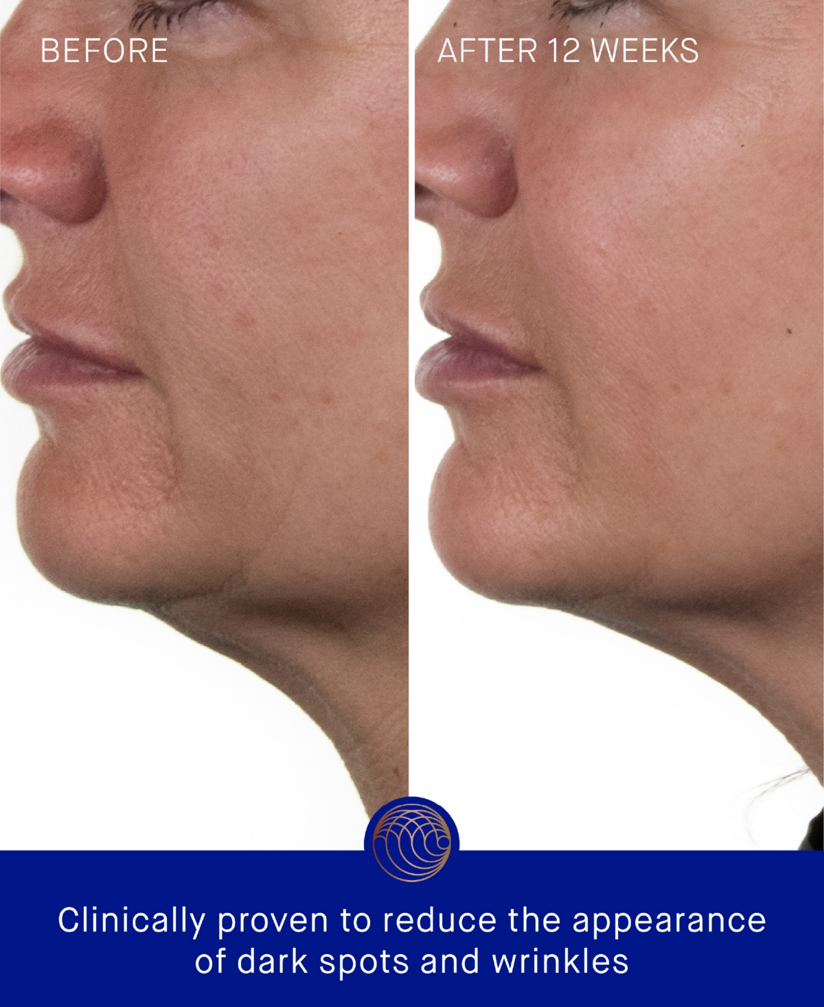 Augustinus Bader 4-pc. The Rich Cream Mini Routine Set In Transparent