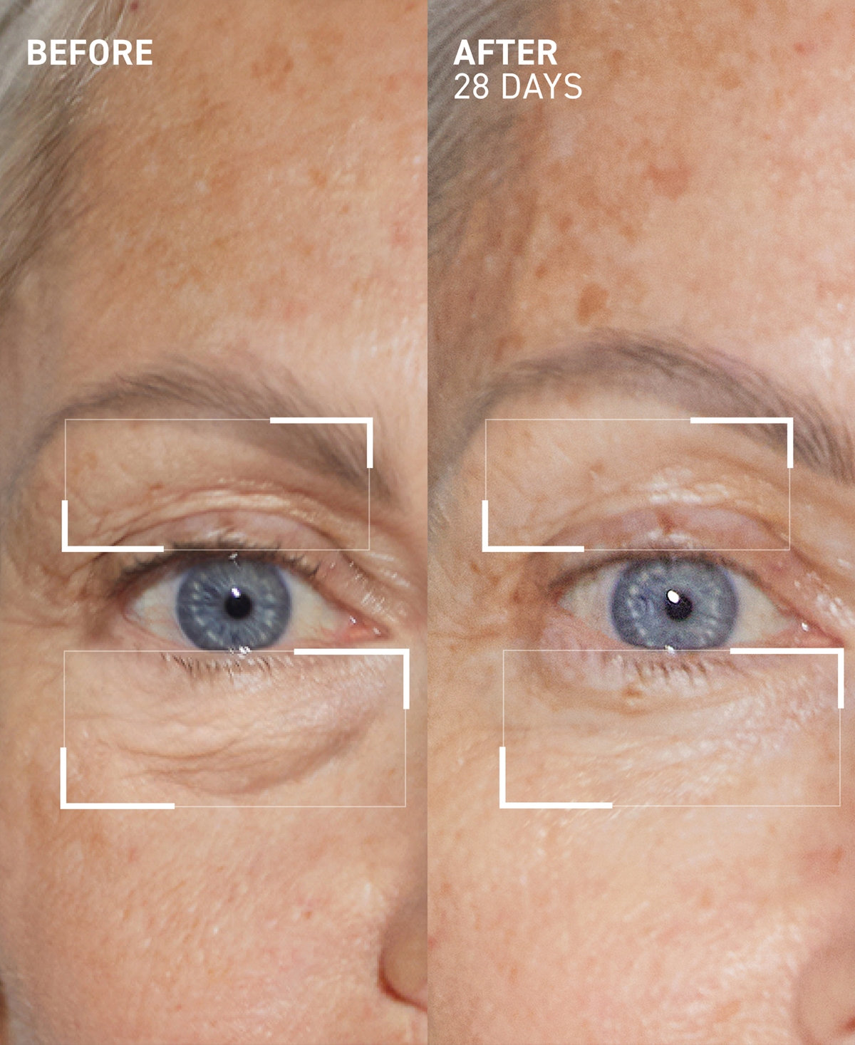 Dr. Brandt 2-pc. Eye Lift And Brightening Duo Set In Transparent