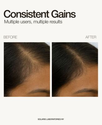 Dermaroller Scalp Ritual Set