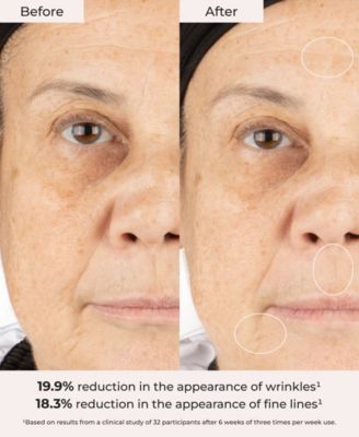 Overnight Resurfacing Mask With AHA & BHA