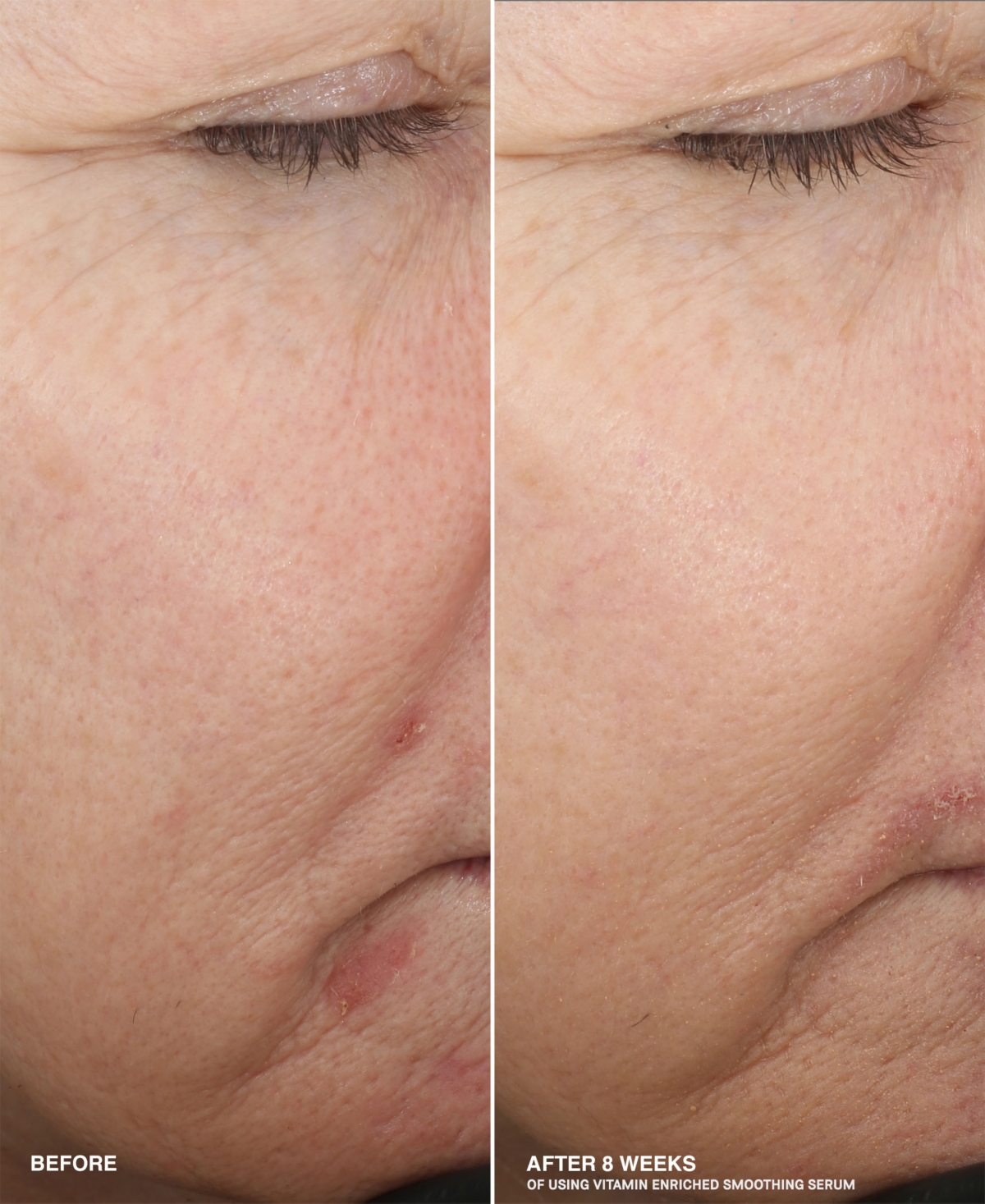 Bobbi Brown Vitamin Enriched Smoothing Niacinamide + Vitamin C Serum, 1 oz.