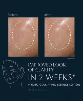 Hydro-Clarifying Essence Lotion, 2.5 oz.