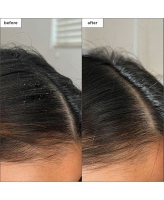 Scalp Revival Charcoal + Tea Tree Buildup Detox Spray, 4 oz.