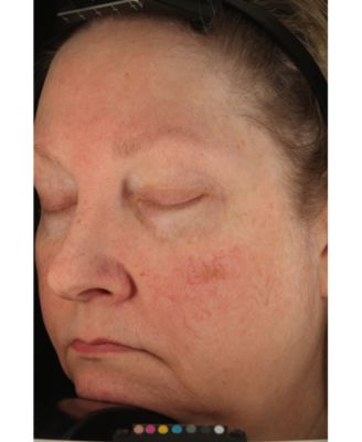 Essential Fx Acyl-Glutathione Rejuvenating Moisturizer, 1-oz.