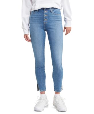 exposed button jeans