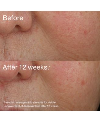 Smart Night™ Clinical MD Multi-Dimensional Repair Treatment Retinol Serum, 1 oz.