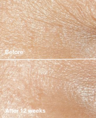 Smart Clinical Repair Wrinkle Correcting Face Cream, 0.5 oz.