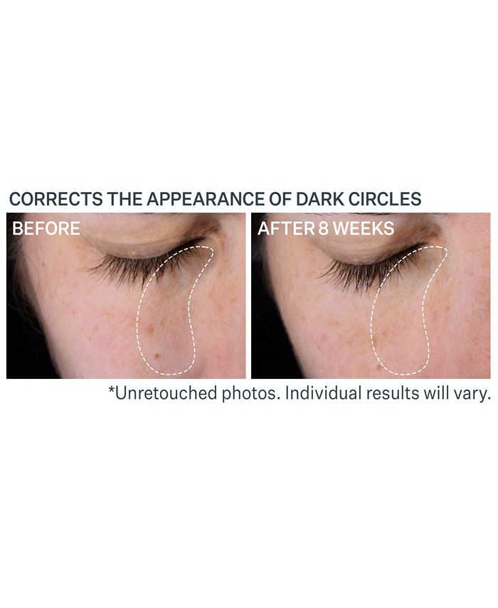 StriVectin SuperC Dark Circle Brightening Eye Serum Macy's