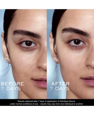 Lancôme 5-Pc. Bestsellers Starter Set