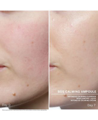 SOS Calming Ampoule Concentrates