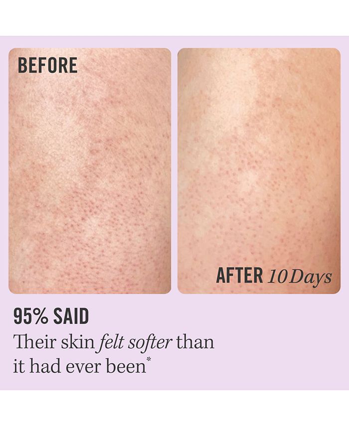 First Aid Beauty KP Bump Eraser Body Scrub w. 10 AHA, 10 oz. Macy's