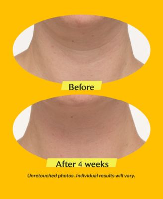 TL Advanced Tightening Neck Cream Plus With Alpha-3 Peptide, 1.7 oz.