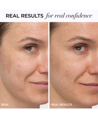 Confidence In A Cream Anti-Aging Hydrating Moisturizer, 2 oz